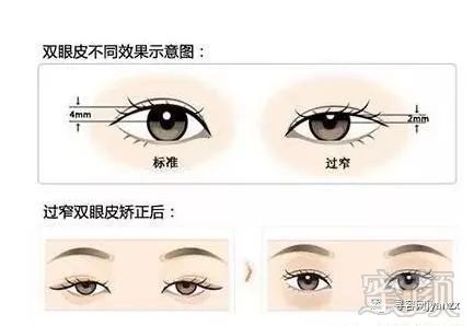 https://img.miyanlife.com/mnt/timg/180808/1136492P2-2.jpg