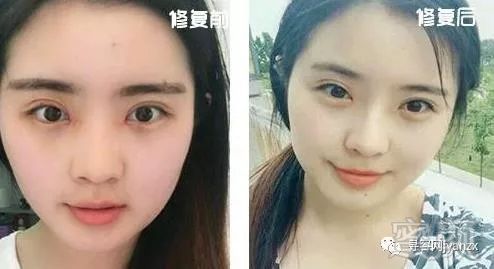 https://img.miyanlife.com/mnt/timg/180808/11364961b-1.jpg