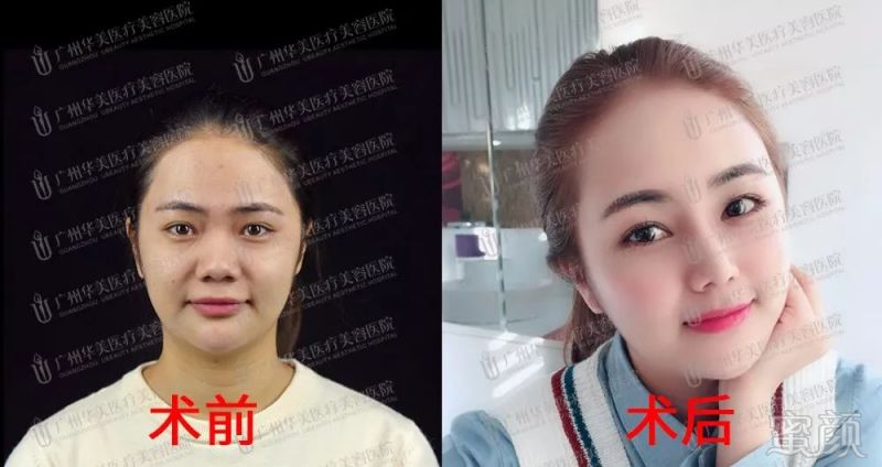 https://img.miyanlife.com/mnt/timg/180808/11461JS3-1.jpg