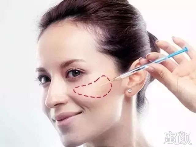 https://img.miyanlife.com/mnt/timg/180808/1152303238-10.jpg