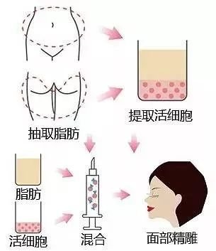 https://img.miyanlife.com/mnt/timg/180808/11523159E-12.jpg