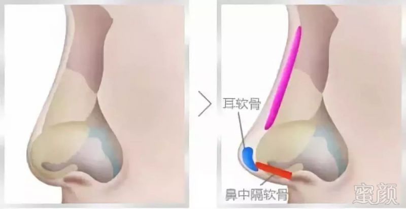 https://img.miyanlife.com/mnt/timg/180808/115443J25-4.jpg
