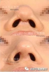 https://img.miyanlife.com/mnt/timg/180808/11550IE1-0.jpg