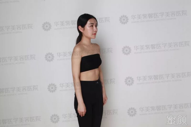 https://img.miyanlife.com/mnt/timg/180808/1205532364-9.jpg