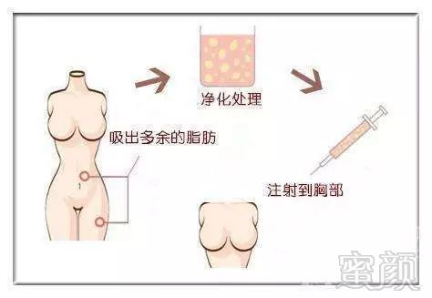 https://img.miyanlife.com/mnt/timg/180808/1205541J1-12.jpg