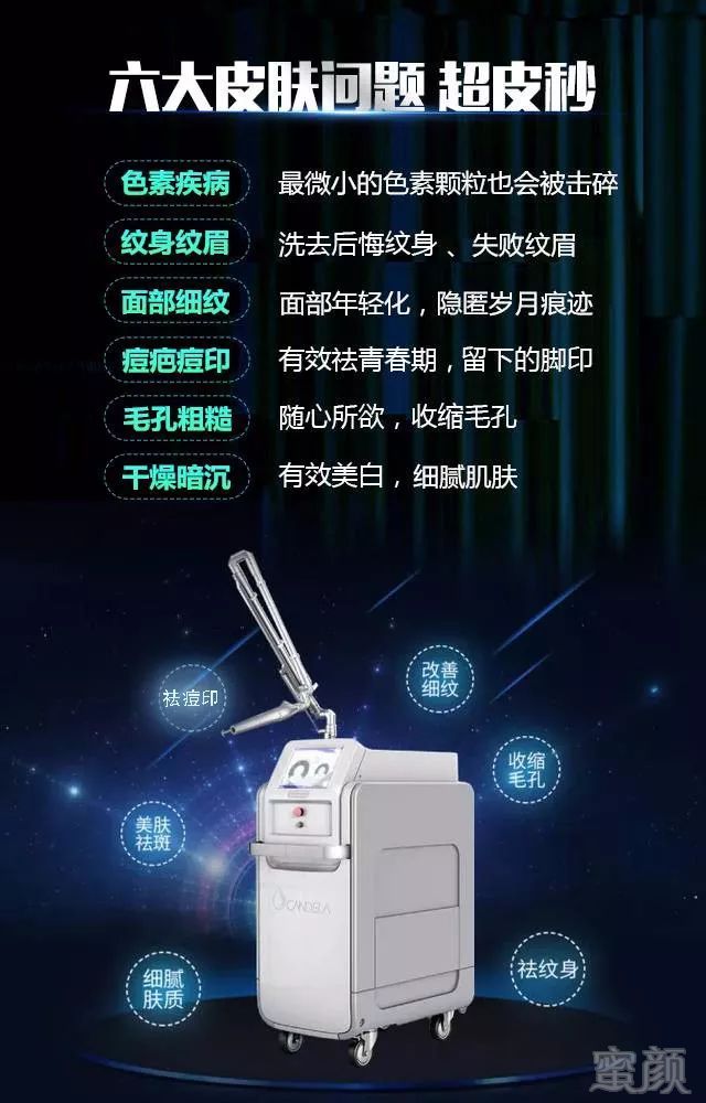 https://img.miyanlife.com/mnt/timg/180808/120RU0F-2.jpg