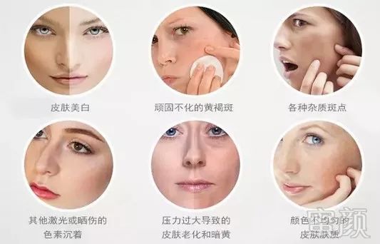 https://img.miyanlife.com/mnt/timg/180808/120RU342-3.jpg