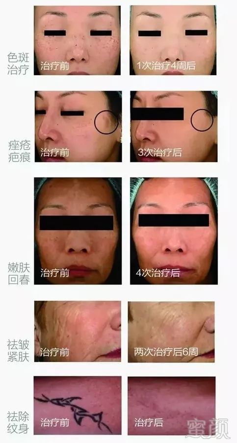 https://img.miyanlife.com/mnt/timg/180808/120T014E-8.jpg