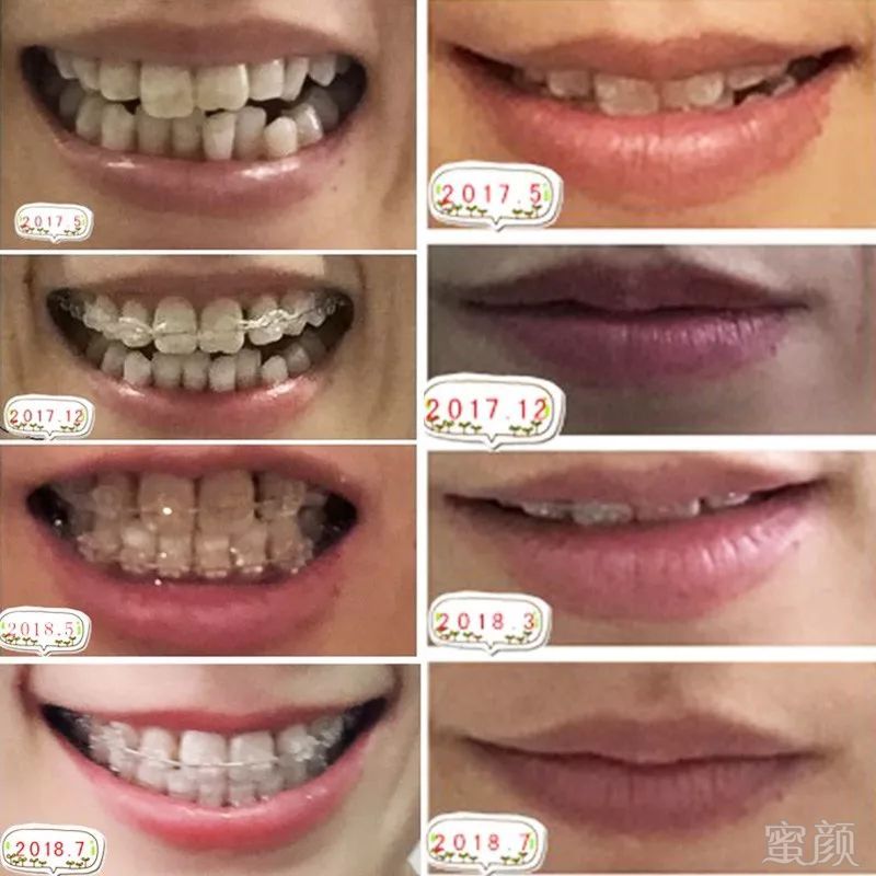 https://img.miyanlife.com/mnt/timg/180808/121K25R2-2.jpg