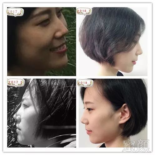 https://img.miyanlife.com/mnt/timg/180808/121K32155-3.jpg