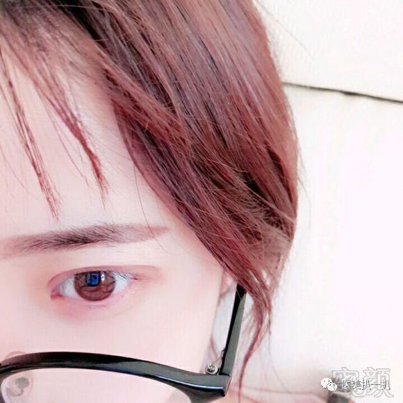 https://img.miyanlife.com/mnt/timg/180809/11323K224-4.jpg