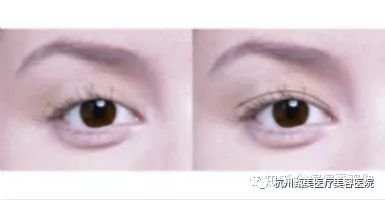 https://img.miyanlife.com/mnt/timg/180809/1136316435-4.jpg