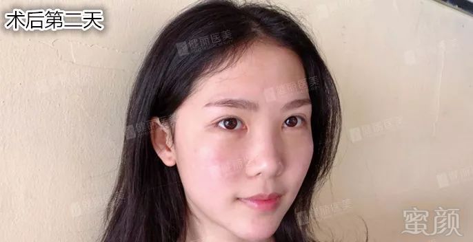 https://img.miyanlife.com/mnt/timg/180809/1150294K1-8.jpg