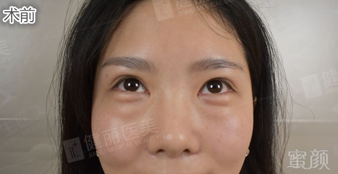 https://img.miyanlife.com/mnt/timg/180809/11502KW0-2.jpg