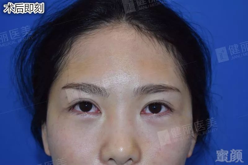 https://img.miyanlife.com/mnt/timg/180809/11502T154-5.jpg