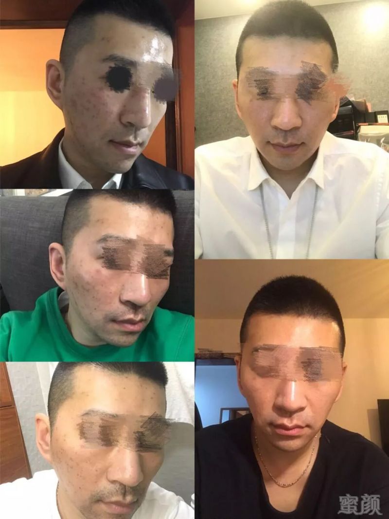 https://img.miyanlife.com/mnt/timg/180809/120221L48-2.jpg