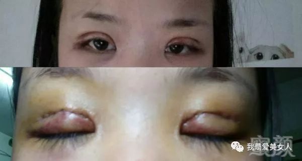 https://img.miyanlife.com/mnt/timg/180809/120555I53-3.jpg