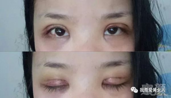 https://img.miyanlife.com/mnt/timg/180809/1205561241-4.jpg