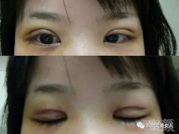 https://img.miyanlife.com/mnt/timg/180809/1205563P5-5.jpg