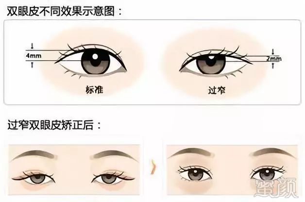 https://img.miyanlife.com/mnt/timg/180809/12061A5G-2.jpg