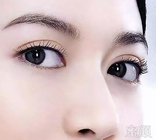 https://img.miyanlife.com/mnt/timg/180809/12061H953-3.jpg