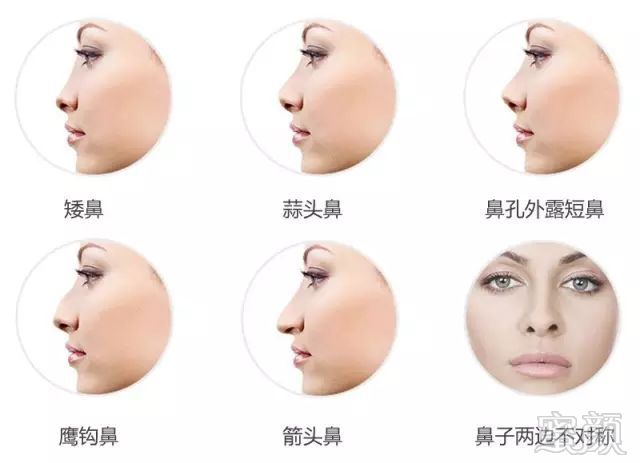 https://img.miyanlife.com/mnt/timg/180809/1221512543-6.jpg