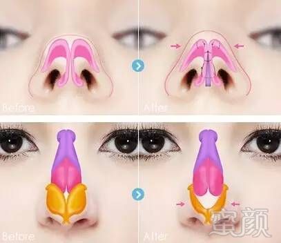 https://img.miyanlife.com/mnt/timg/180809/123304O40-9.jpg