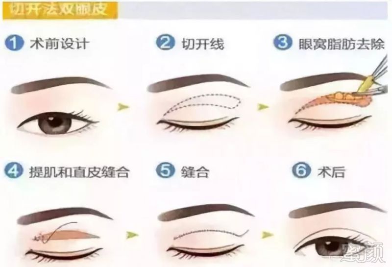 https://img.miyanlife.com/mnt/timg/180809/1249463V2-1.jpg