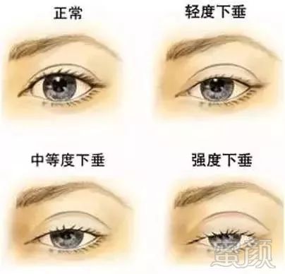 https://img.miyanlife.com/mnt/timg/180809/12525154b-3.jpg