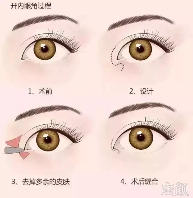 https://img.miyanlife.com/mnt/timg/180809/1252532026-8.jpg
