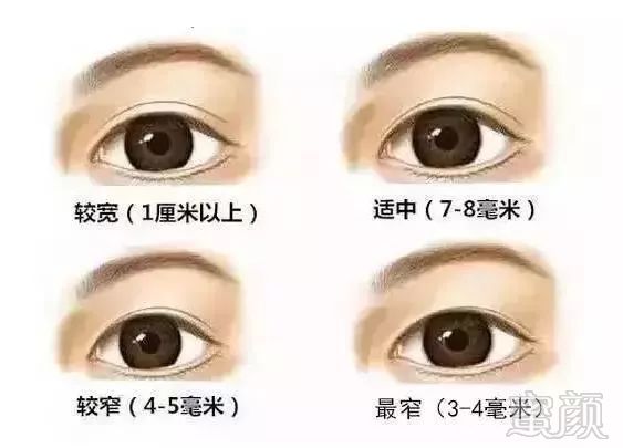 https://img.miyanlife.com/mnt/timg/180809/12525W453-10.jpg