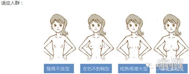 https://img.miyanlife.com/mnt/timg/180809/1253353138-0.jpg