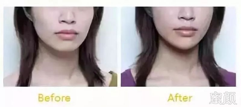 https://img.miyanlife.com/mnt/timg/180809/12545952S-6.jpg