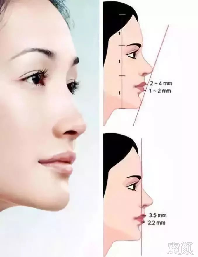 https://img.miyanlife.com/mnt/timg/180809/12545G092-1.jpg