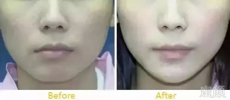 https://img.miyanlife.com/mnt/timg/180809/12545W500-4.jpg