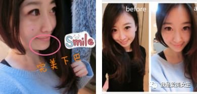 https://img.miyanlife.com/mnt/timg/180809/1255231Y2-1.jpg