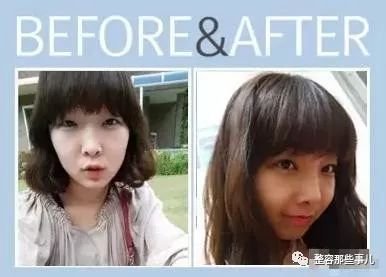 https://img.miyanlife.com/mnt/timg/180809/13161450O-4.jpg