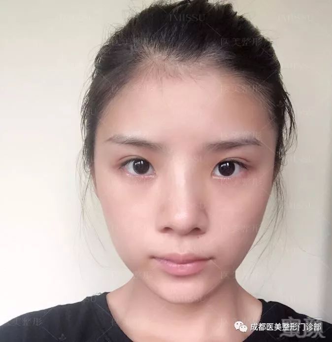 https://img.miyanlife.com/mnt/timg/180809/131Q3H48-5.jpg