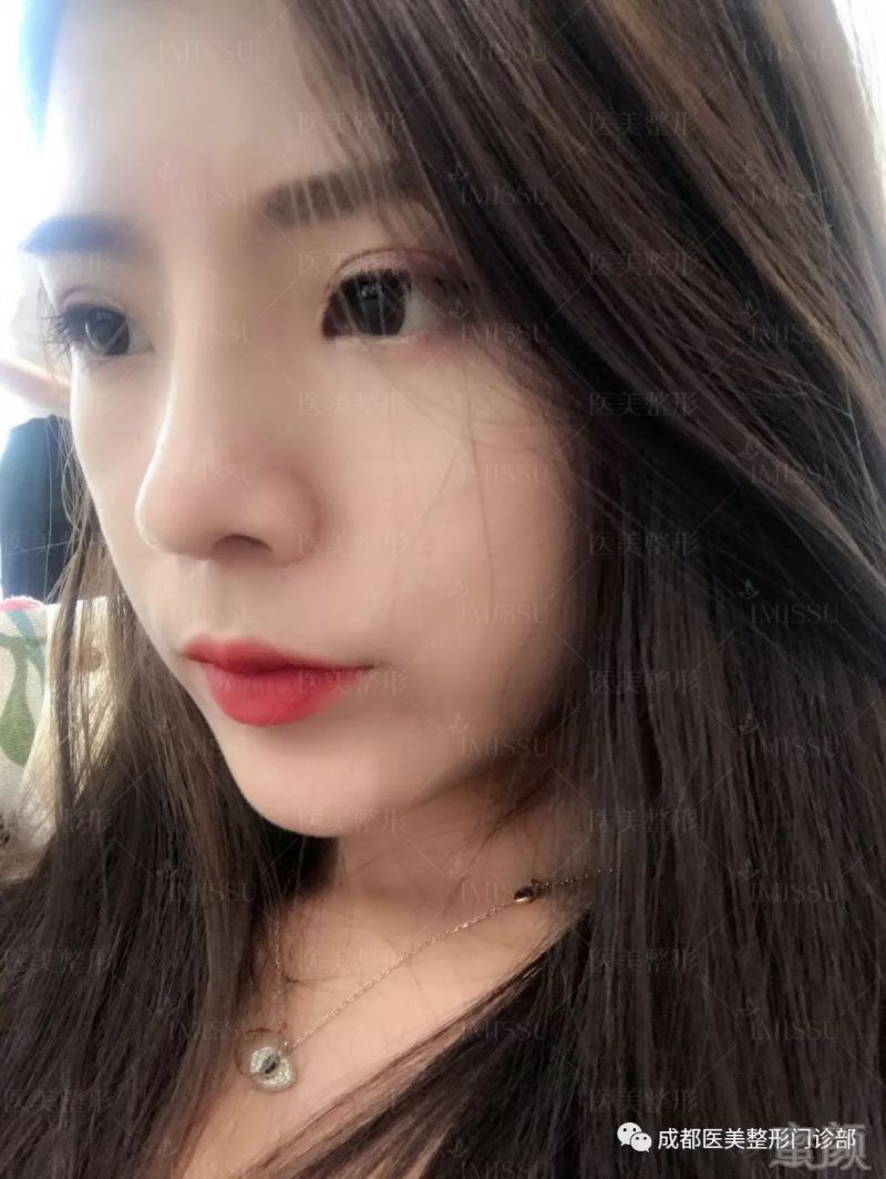 https://img.miyanlife.com/mnt/timg/180809/131Q412W-6.jpg