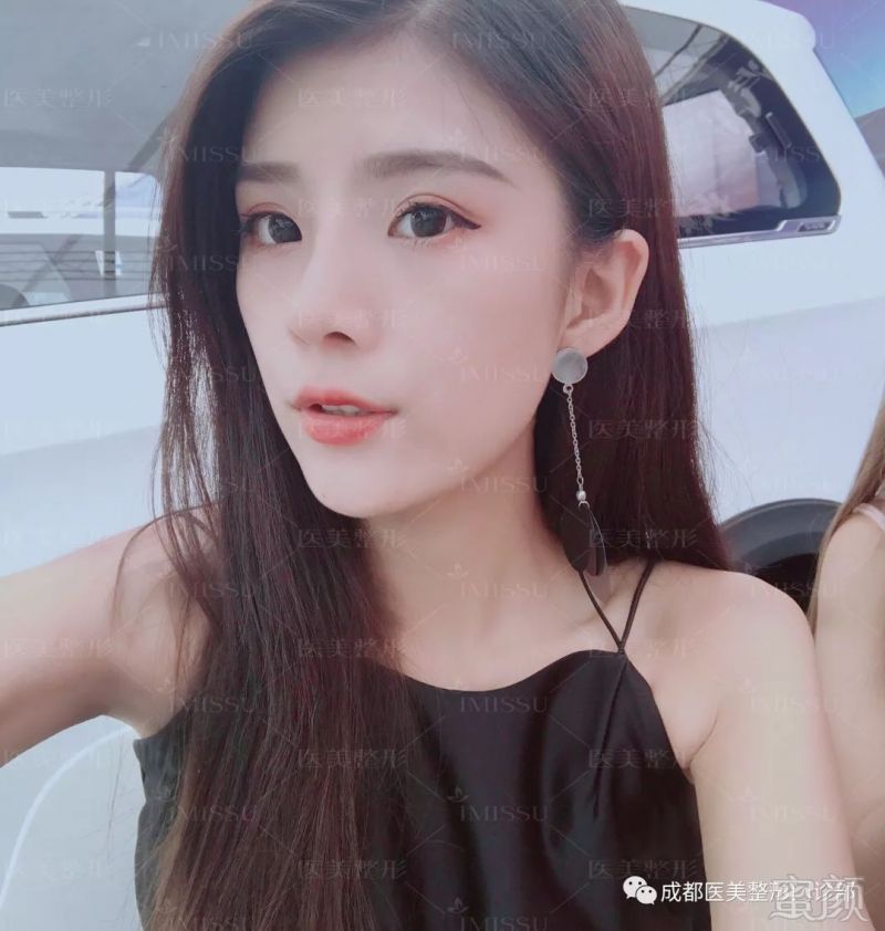https://img.miyanlife.com/mnt/timg/180809/131Q54E5-7.jpg