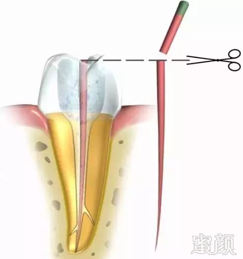 案例图片