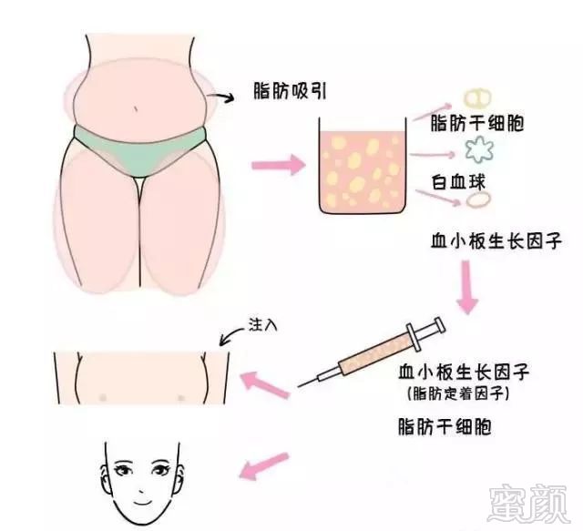 https://img.miyanlife.com/mnt/timg/180810/1152454010-2.jpg