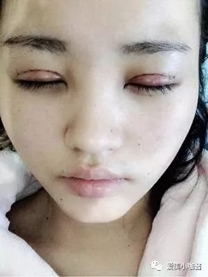 https://img.miyanlife.com/mnt/timg/180810/11595a400-3.jpg