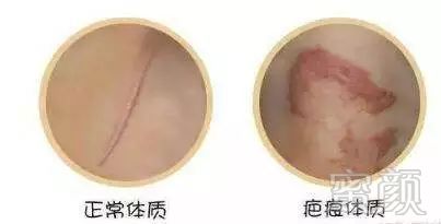 https://img.miyanlife.com/mnt/timg/180810/1200025939-6.jpg