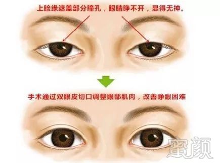 https://img.miyanlife.com/mnt/timg/180810/1200243913-4.jpg
