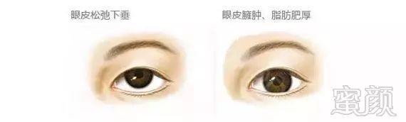 https://img.miyanlife.com/mnt/timg/180810/120024D06-5.jpg