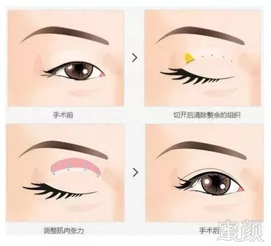 https://img.miyanlife.com/mnt/timg/180810/120024Dc-6.jpg