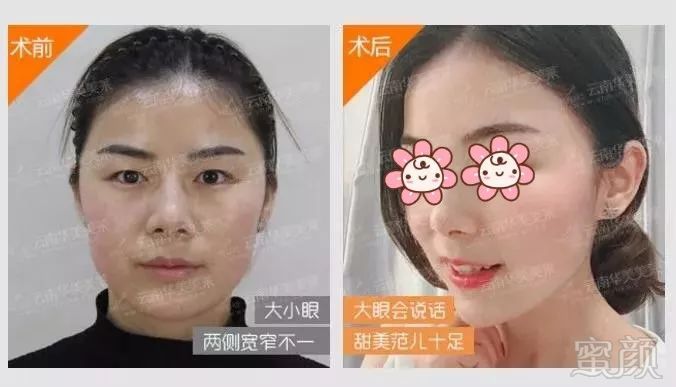 https://img.miyanlife.com/mnt/timg/180810/1200254350-8.jpg