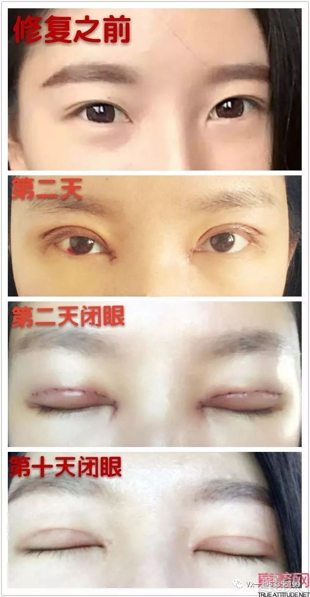 https://img.miyanlife.com/mnt/timg/180810/1222533V1-0.jpg
