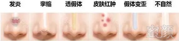 https://img.miyanlife.com/mnt/timg/180810/122FC2P-3.jpg